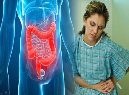 ulcerative colitis - we know how to help you